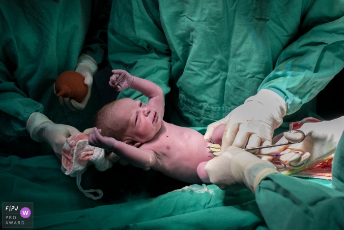 The doctor and nurses cut a baby's umbilical cord in this documentary birth photo by a Minas Gerais photographer.