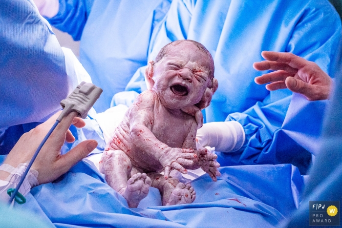 Nurses hold a crying newborn infant in the hospital in this documentary birth picture captured by an award-winning Rio de Janeiro, Brazil photographer.