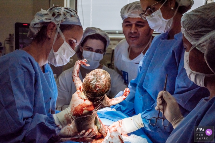 Photo by: <a href="https://www.fpja.com/documentary-family-photography-contests/claudia-ruiz/rio-de-janeiro/2097866">Claudia Ruiz - Brazil</a> Nurses work to carefully free a baby from a C-section in this image recorded by a Rio de Janeiro, Brazil birth photographer.