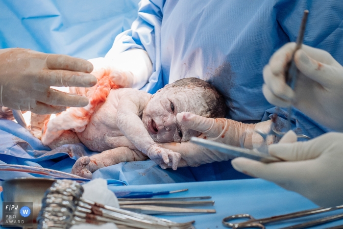 Rio de Janeiro Brésil Bébé né à Maternidade Santa Lucia