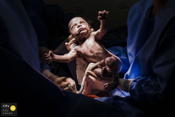 Photo by: <a href="https://www.fpja.com/documentary-family-photography-contests/clara-sampaio/rio-de-janeiro/2104409">Clara Sampaio - Brazil</a> Rio de Janeiro Brazil Maternidade Perinatal Laranjeiras delivery of new baby - The perfect nature
