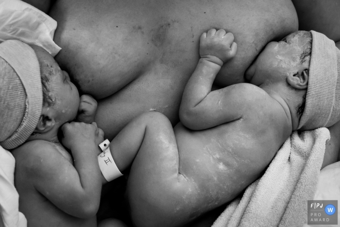 Photo par: Louise van den Broek - Pays-Bas Premier allaitement au sein 30 minutes après leur naissance | Séance photo à l'hôpital d'Isla