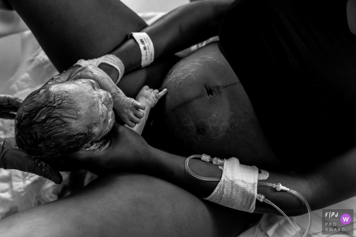 Photo by: <a href="https://www.fpja.com/documentary-family-photography-contests/louise-van-den-broek/flevoland/2105357">Louise van den Broek - Netherlands</a> Mom catches her baby after a short and intense labor at the Isala in the Netherlands