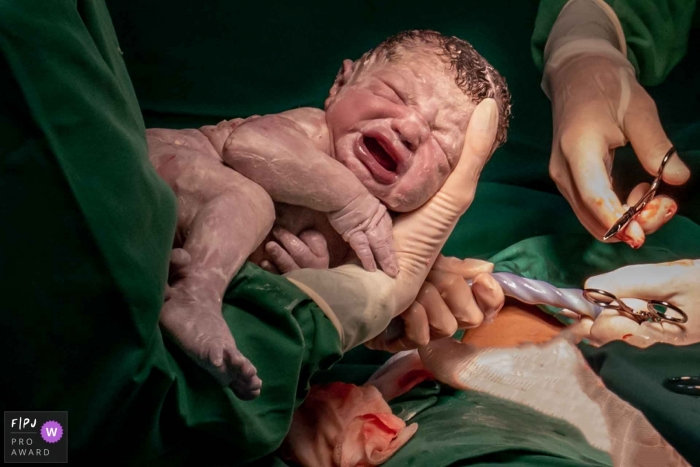 Photo by: <a href="https://www.fpja.com/documentary-family-photography-contests/alessandra-corveloni/rio-de-janeiro/2105714">Alessandra Corveloni - Brazil</a> He arrived at the obstetrician's comfort at Maternidade LiliaNeves | Rio de Janeiro family photo