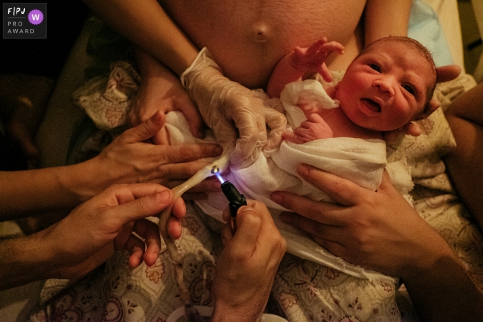 Photo by: <a href="https://www.fpja.com/documentary-family-photography-contests/marcos-paulo/sao-paulo/2105889">Marcos Paulo - Brazil</a> The umbilical cord being cut right after birth | Brazil birthing photographer
