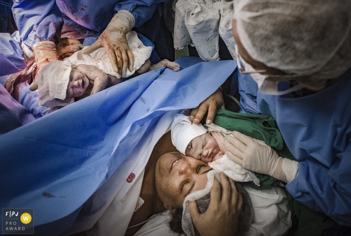 Photo by: <a href="https://www.fpja.com/documentary-family-photography-contests/clara-sampaio/rio-de-janeiro/2106265">Clara Sampaio - Brazil</a> A mother relieved to finally have her baby next to her as a second one is being prepared to meet her also at Perinatal Barra da Tijuca
