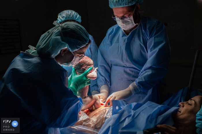 Photo by: <a href="https://www.fpja.com/documentary-family-photography-contests/cibele-piovesan/sao-paulo/2106621">Cibele Piovesan - Brazil</a> A mother watching the caesarean birth of her child at the Hospital Albert Einstein | São Paulo, Brazil birth image