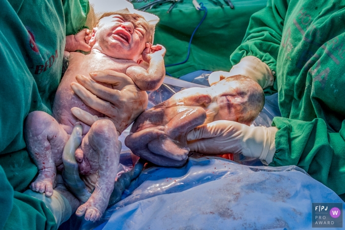 Photo by: <a href="https://www.fpja.com/documentary-family-photography-contests/alessandra-corveloni/rio-de-janeiro/2109000">Alessandra Corveloni - Brazil</a> RJ family and birth photography at Maternidade Lilia Neves as twins are being born in Brazil