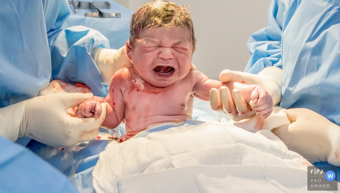 Photo by: <a href="https://www.fpja.com/documentary-family-photography-contests/alessandra-corveloni/rio-de-janeiro/2110738">Alessandra Corveloni - Brazil</a> Hospital documentary birth photography in Campos dos Goytacazes showing the baby arrived making many faces