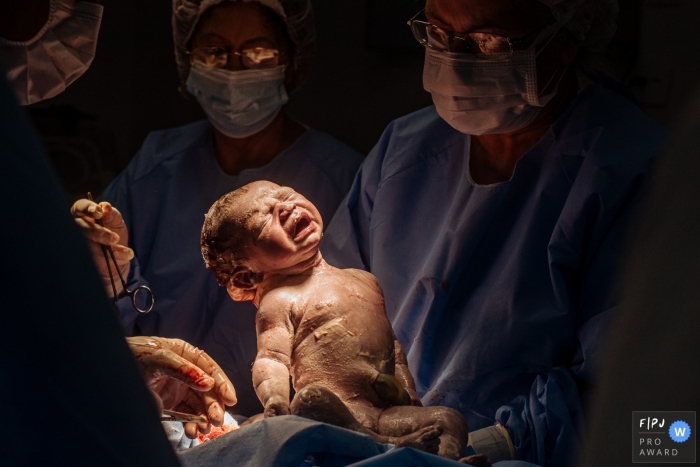 Photo by: <a href="https://www.fpja.com/documentary-family-photography-contests/claudia-ruiz/rio-de-janeiro/2111634">Claudia Ruiz - Brazil</a> Maternidade Perinatal Laranjeiras hospital birth image of the doctors watching newborn