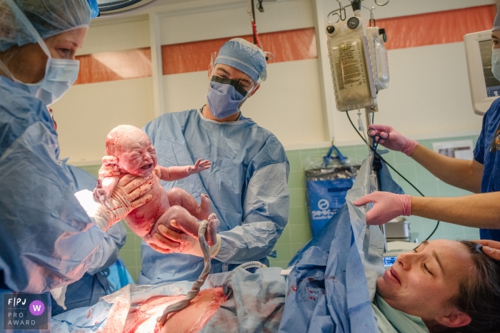 Photo par: Viara Mileva - Canada Photographie de naissance à l'hôpital général de Kingston, axée sur le moment, d'un premier regard entre maman et son nouveau bébé