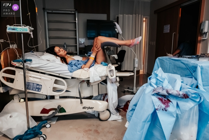 Moment driven Hospital Albert Einsten birth photojournalism image of an exhausted mother after labor Moment driven Hospital Albert Einsten birth photojournalism image of an exhausted mother after labor