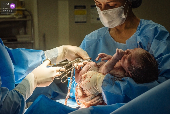 Moment driven Maternidade Perinatal Barra birth photojournalism image showing the cord being cut