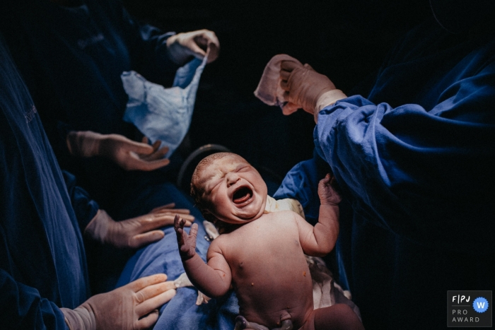 Maternidade Santa Helena birth image showing the newly born baby just delivered crying out Maternidade Santa Helena birth image showing the newly born baby just delivered crying out